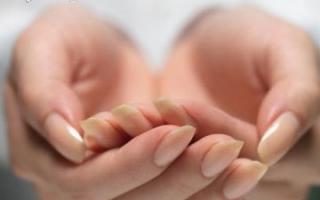 Příčiny prasklin na prstech a jejich léčba