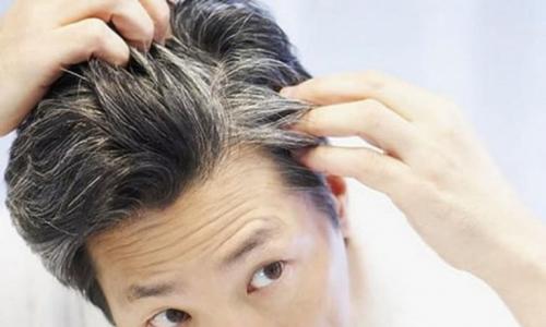 Mengapa rambut beruban: penyebab utama uban